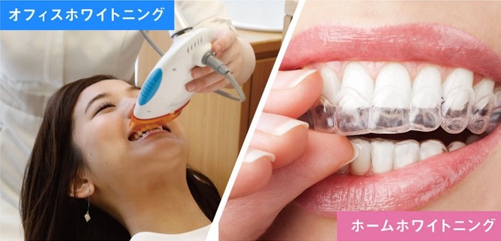 ホワイトニングとは